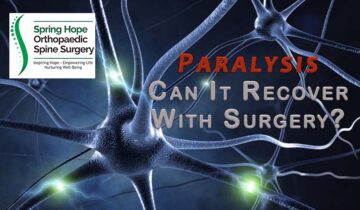 Paralysis | Can It Recover with Surgery?